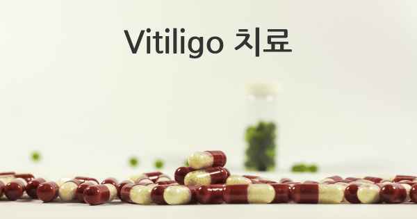 Vitiligo 치료