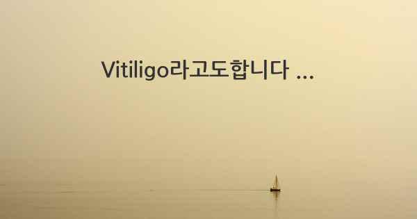 Vitiligo라고도합니다 ...