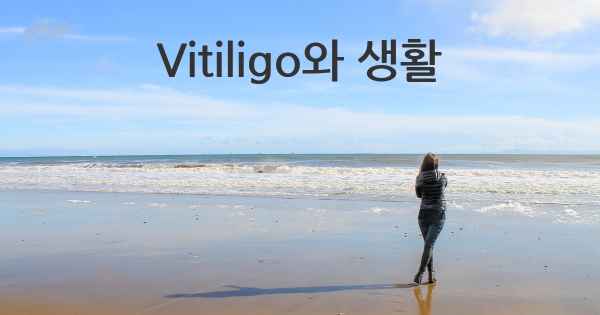 Vitiligo와 생활