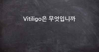 Vitiligo은 무엇입니까