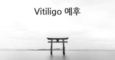 Vitiligo 예후