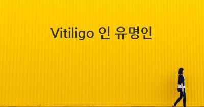 Vitiligo 인 유명인