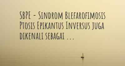 SBPE - Sindrom Blefarofimosis Ptosis Epikantus Inversus juga dikenali sebagai ...