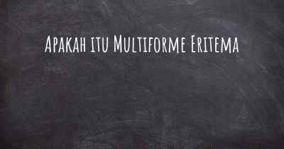 Apakah itu Multiforme Eritema