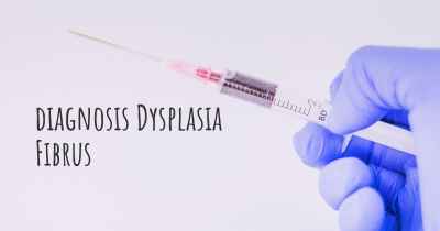 diagnosis Dysplasia Fibrus