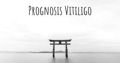 Prognosis Vitiligo