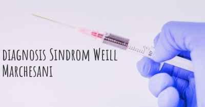 diagnosis Sindrom Weill Marchesani