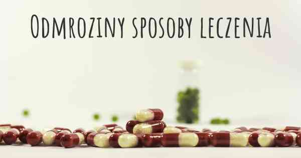 Odmroziny sposoby leczenia