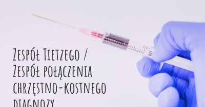 Zespół Tietzego / Zespół połączenia chrzęstno-kostnego diagnozy