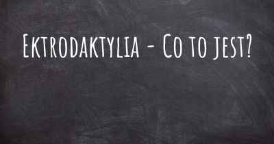 Ektrodaktylia - Co to jest?