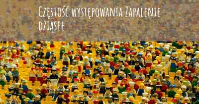 Częstość występowania Zapalenie dziąseł