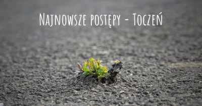 Najnowsze postępy - Toczeń