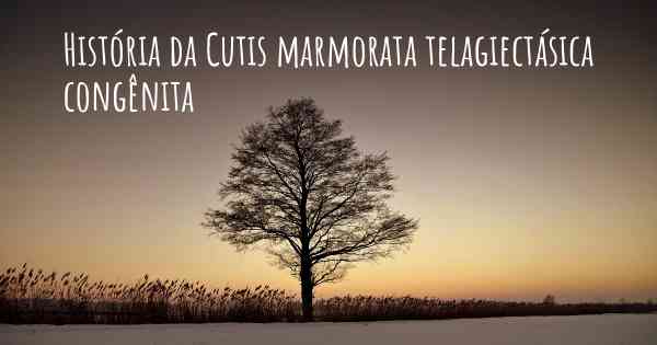 História da Cutis marmorata telagiectásica congênita