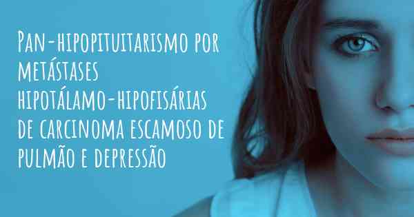 Pan-hipopituitarismo por metástases hipotálamo-hipofisárias de carcinoma escamoso de pulmão e depressão