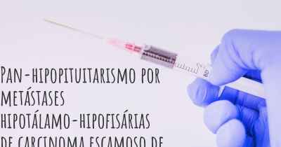 Pan-hipopituitarismo por metástases hipotálamo-hipofisárias de carcinoma escamoso de pulmão - diagnóstico