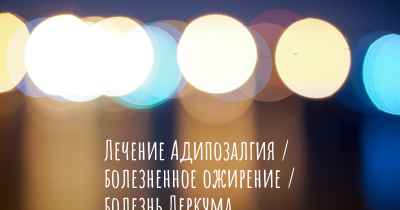 Лечение Адипозалгия / болезненное ожирение / болезнь Деркума