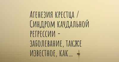 Агенезия крестца / Синдром каудальной регрессии - заболевание, также известное, как…