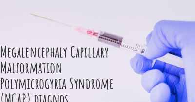 Megalencephaly Capillary Malformation Polymicrogyria Syndrome (MCAP) diagnos
