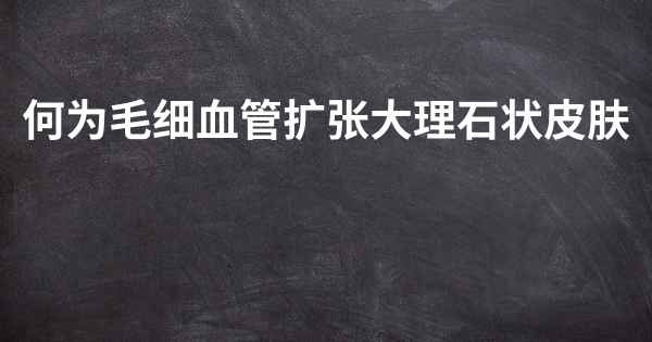 何为毛细血管扩张大理石状皮肤