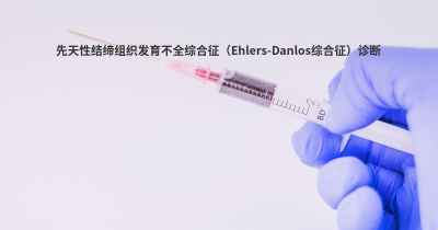 先天性结缔组织发育不全综合征（Ehlers-Danlos综合征）诊断
