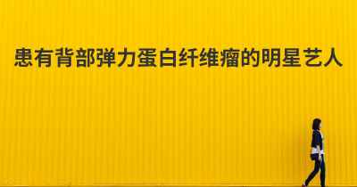 患有背部弹力蛋白纤维瘤的明星艺人