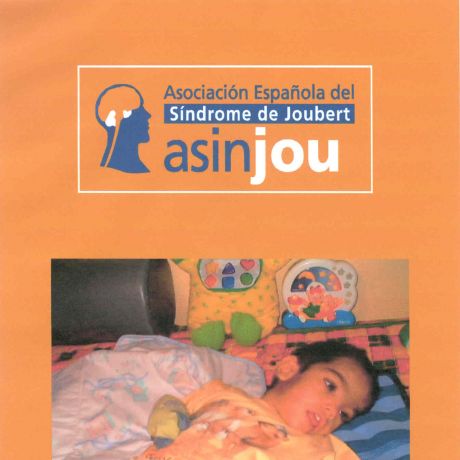 Asociación Española del Síndrome de Joubert