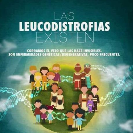 Leucodistrofias Perú