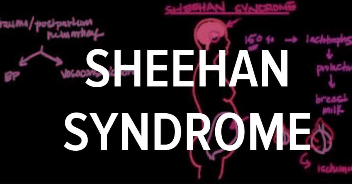 Historia sobre Síndrome De Sheehan