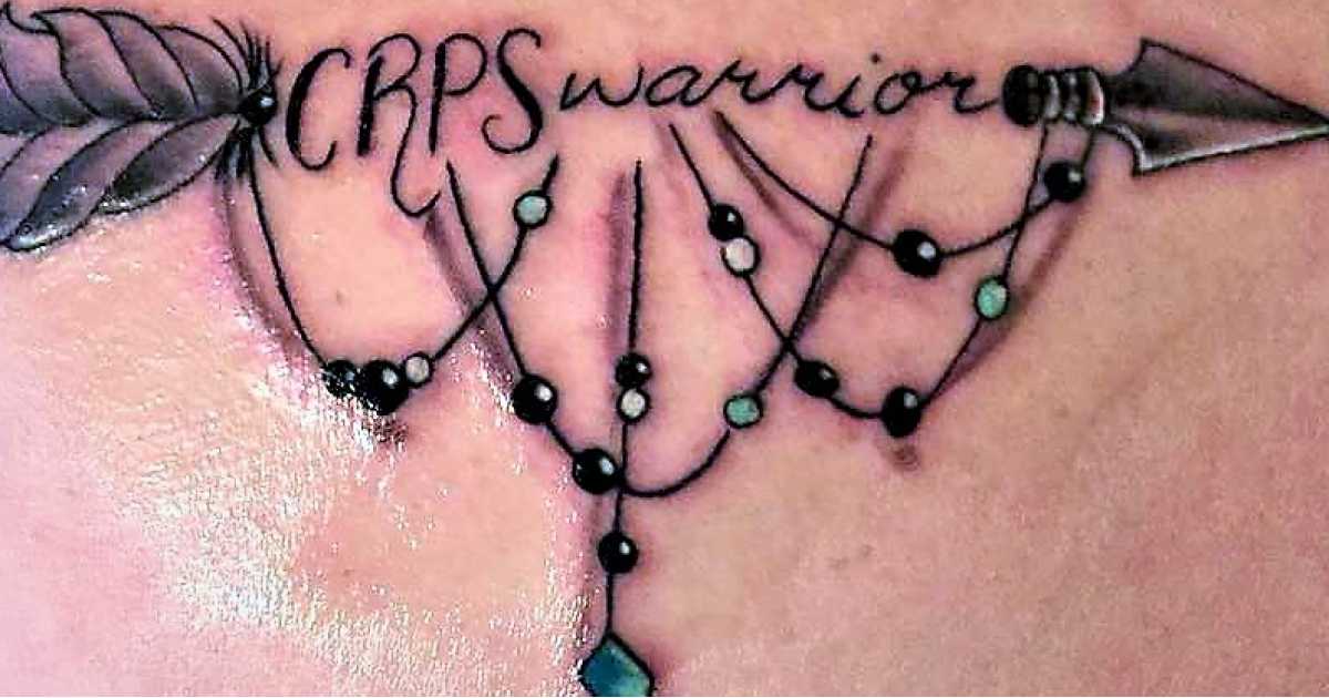Story about CRPS Complex Regional Pain Syndrome