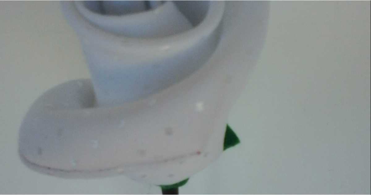 Historia sobre Liquen Escleroso